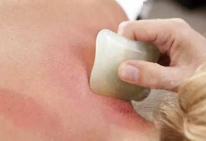 "为什么要常做肩颈刮痧?"_循环