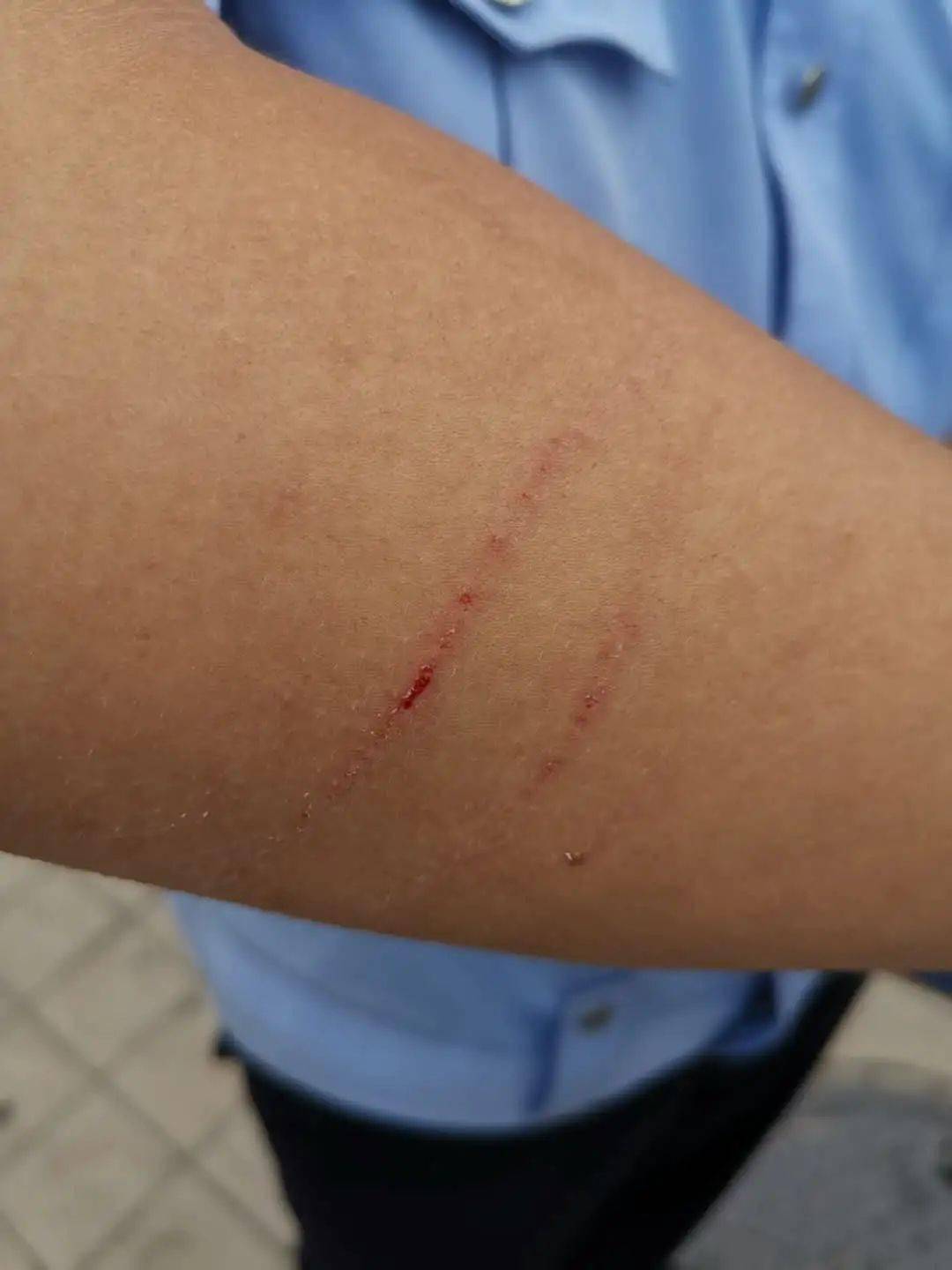 德州蛮横女撒泼还抓伤民警被曝光拘八天