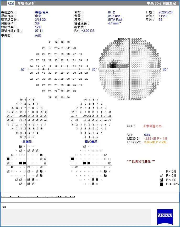 每周最佳病例分享 | 视神经炎-搜狐大视野-搜狐新闻