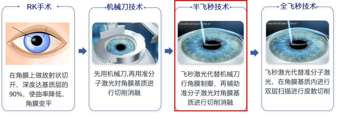 角膜基质层屈光手术的发展历程角膜基质层屈光手术