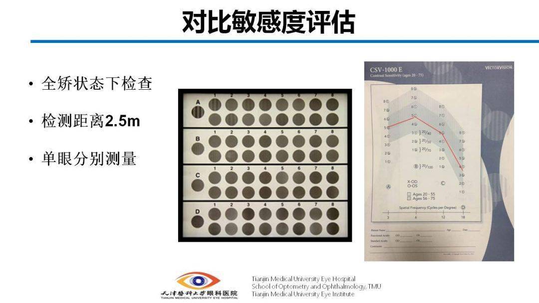 眼视光对比敏感度检测与临床应用