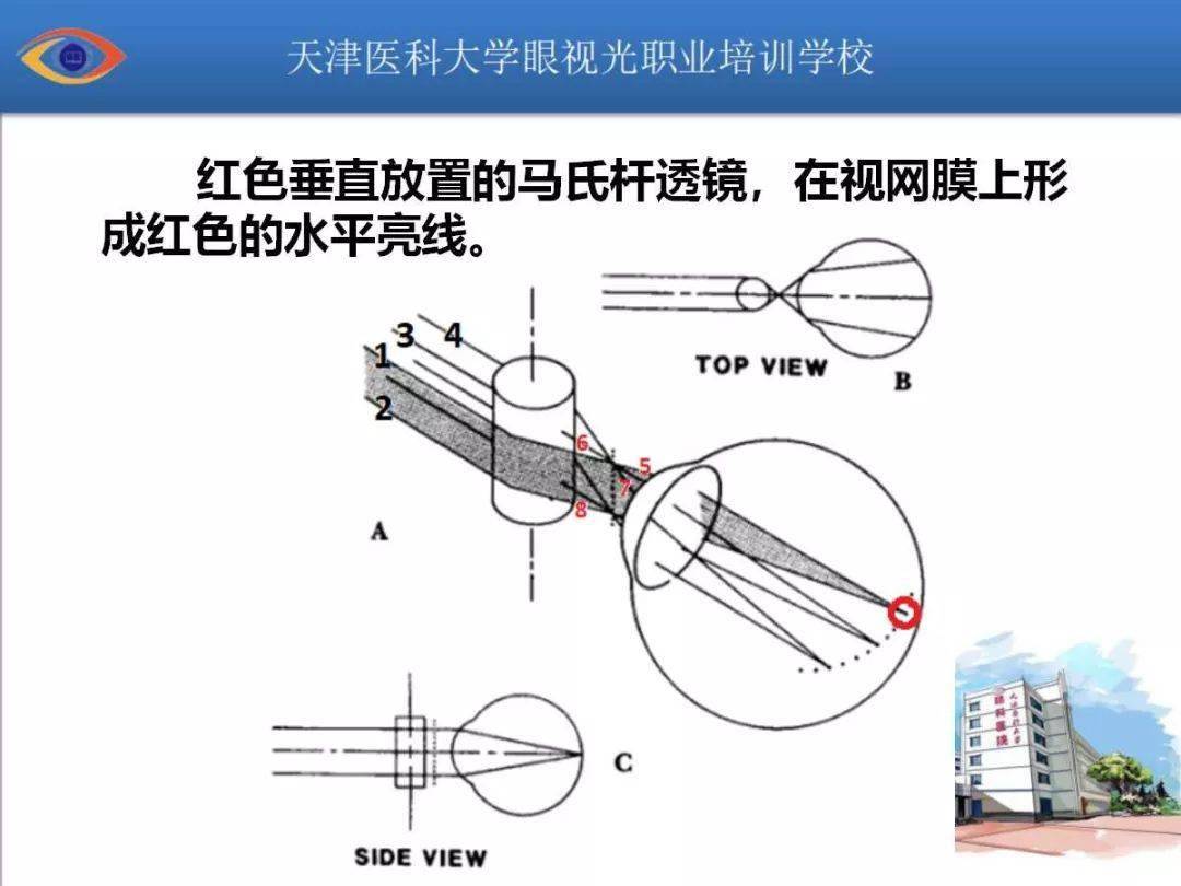 眼视光平柱面透镜及马氏杆成像