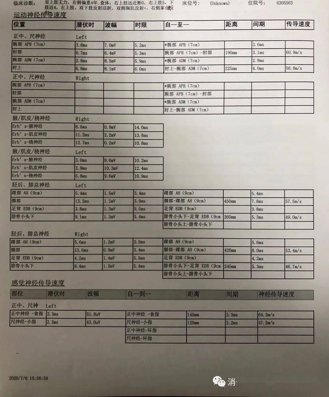 尊敬!渐冻症早期的8个征兆亲身经历