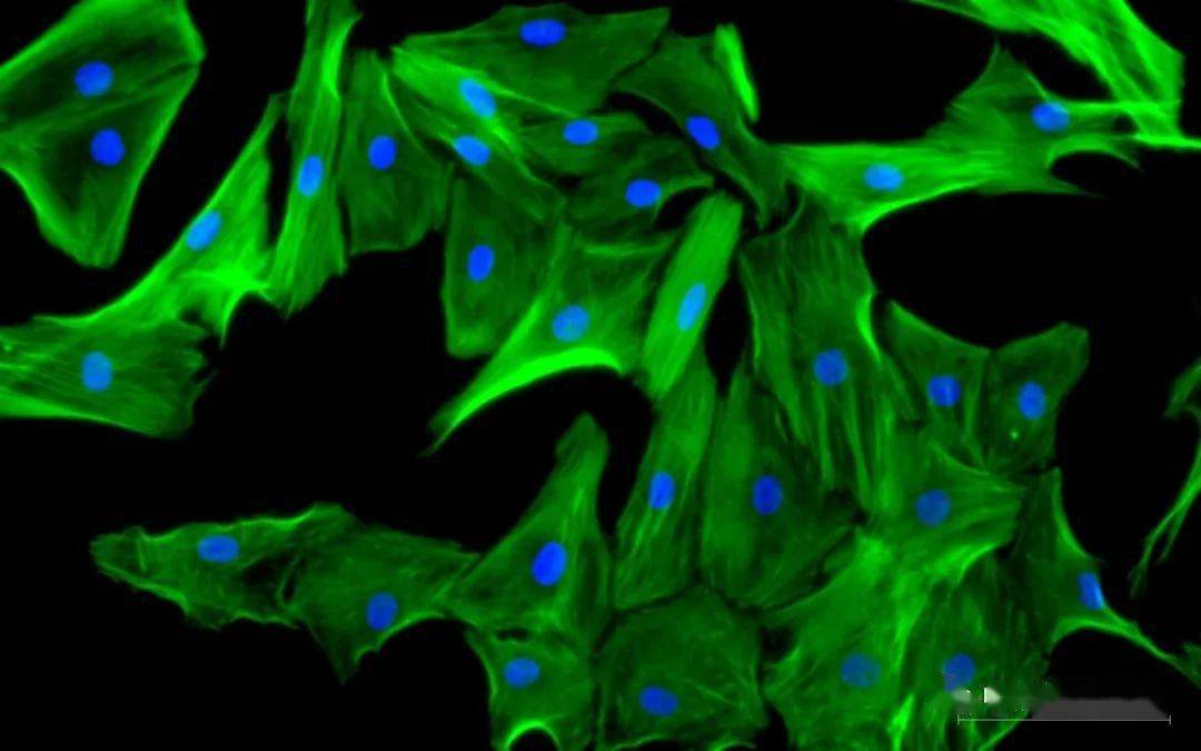 实验专栏丨教你解决鬼笔环肽染色常见问题