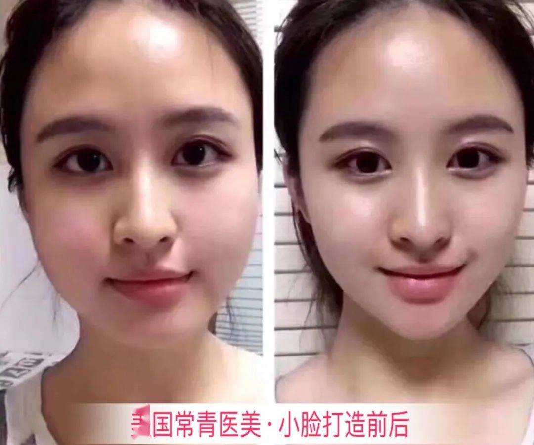 的常青医美中心,主打微整形和皮肤美容,瘦身溶脂项目亲测有效还不反弹