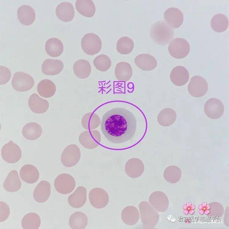 09形态特征:胞体不规则形;胞质丰富,呈淡蓝色,含有较多,大小不一的