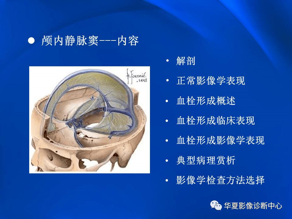 学习不倦颅内静脉窦血栓形成的影像学表现