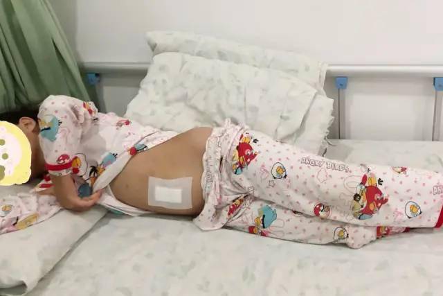 桂林9岁女孩肚子变大,家长以为是长胖!医生检查.