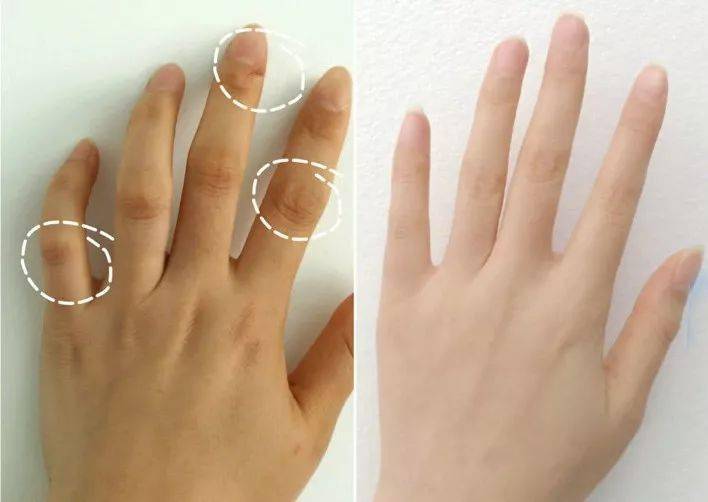 轻轻一抹,双手一夜重回婴儿肌!