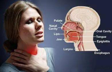 二环咽肌功能障碍等同于环咽肌失弛缓症吗