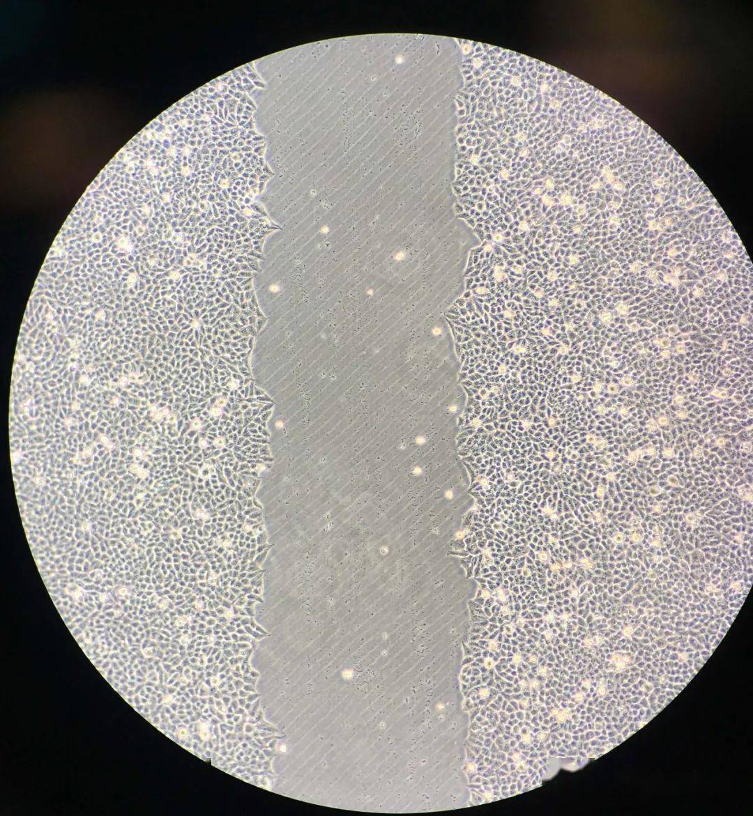 细胞划痕实验结果图图片