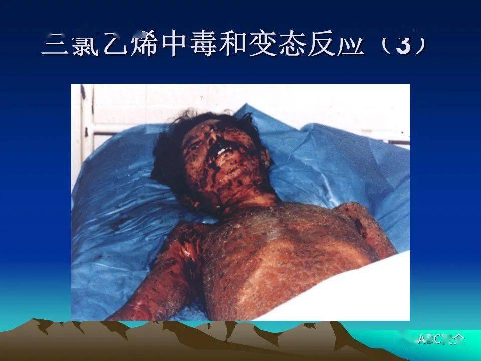 职业卫生与职业病防治知识ppt