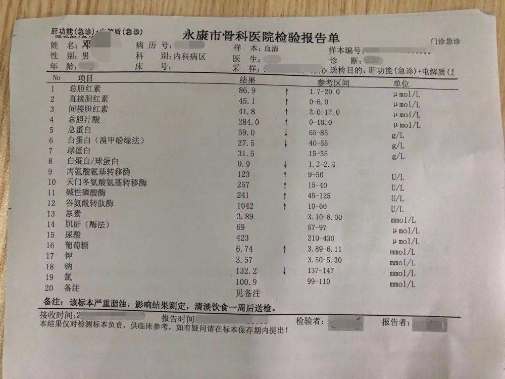 每天半斤白酒打底永康一男子患上这种病