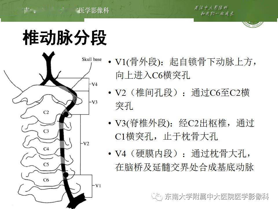 解剖頭部血管解剖及willis環常見變異