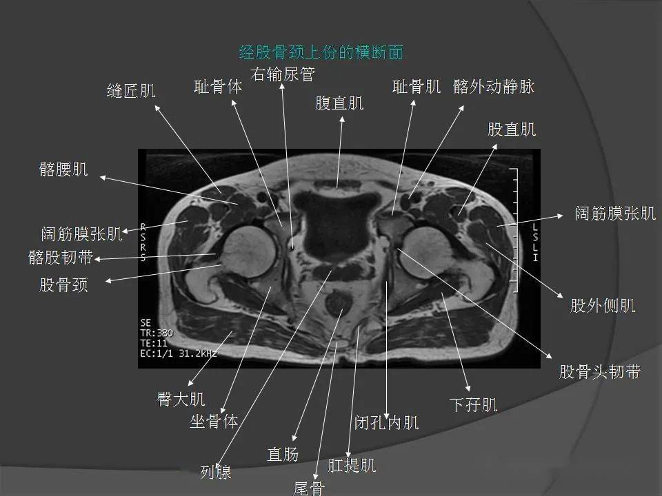 合体解剖图核磁共振图片
