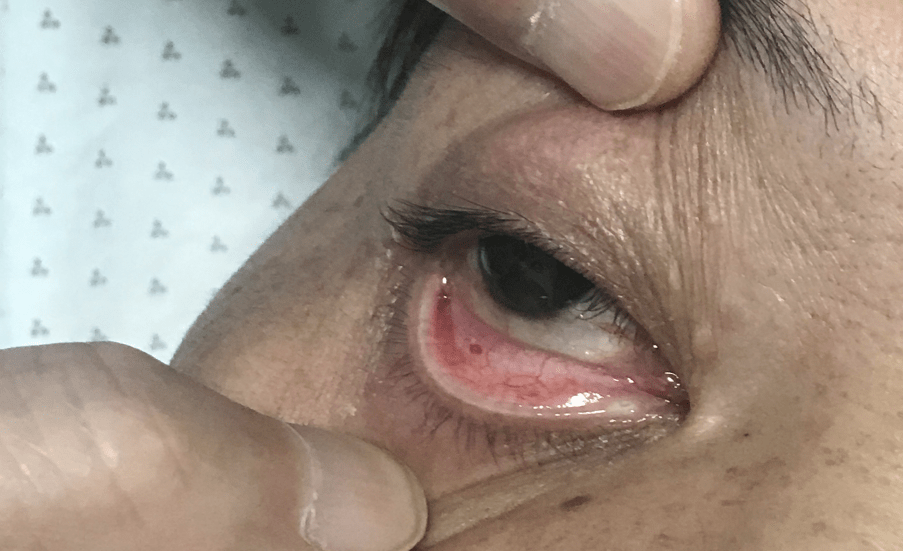 遇到患者不再慌手把手教你如何根据指南明确诊疗思路