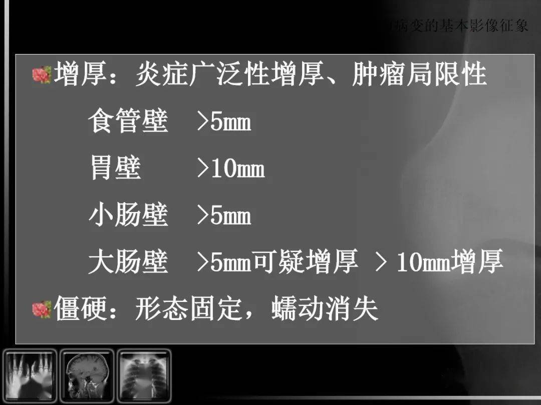 位置,移动度改变1)外压:纵膈,腹腔肿瘤 肝左叶占位 胰头癌2)本身粘连