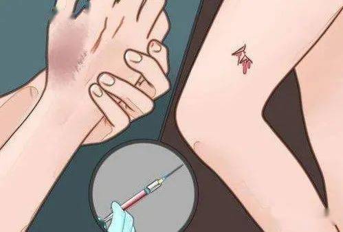 答:破伤风感染后发病的潜伏期为6-12天,伤后24h之内,甚至稍晚应用