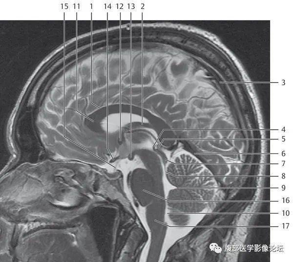 头颅磁共振解剖图片