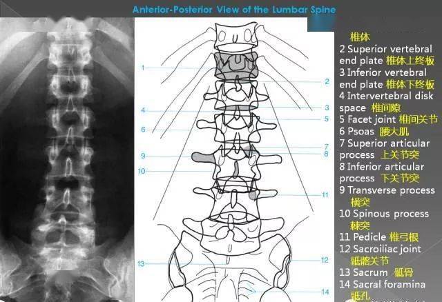 有無移行椎(見後),隱裂,棘突偏歪,椎間隙兩側是否等寬,椎弓根,關節突