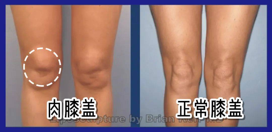 所以本身骨架大 膝盖肉多,会推荐你们直接穿这类云朵拖地裤,垂坠,飘逸