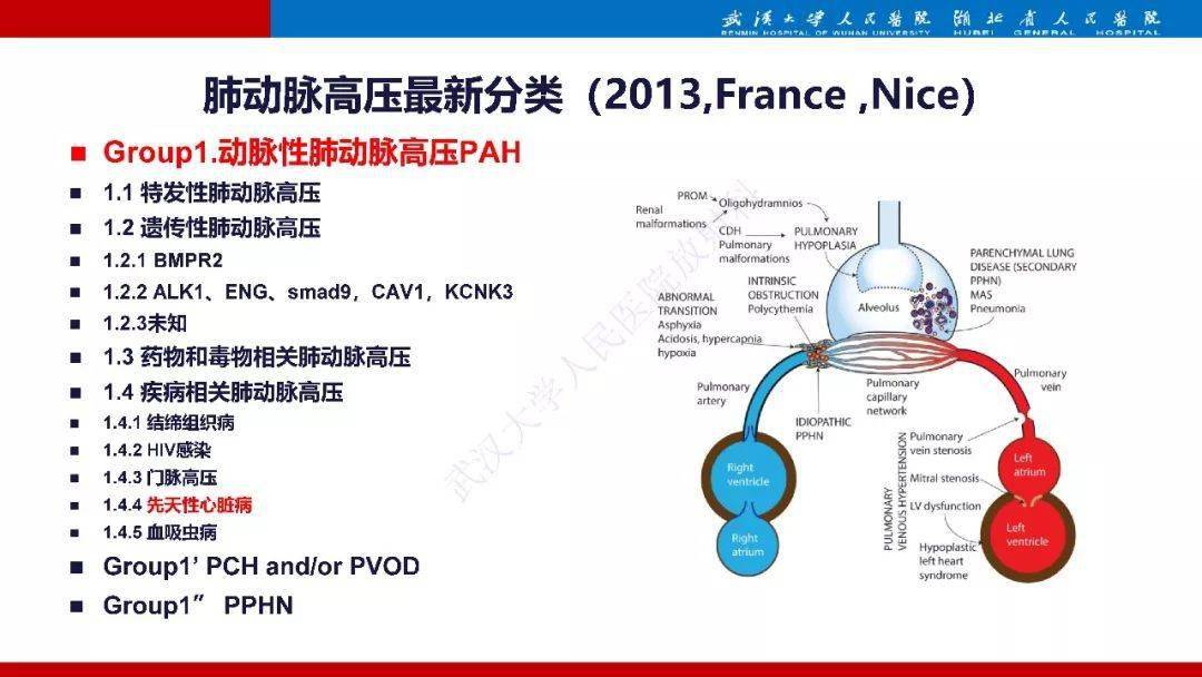 肺动脉高压临床分类及ct表现