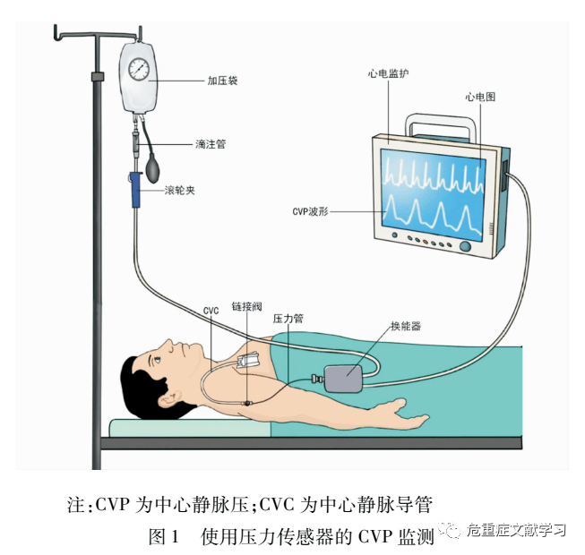 中心静脉压急诊临床应用中国专家共识2020