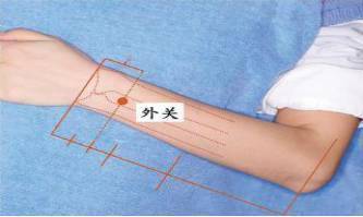 腕管综合征鼠标手的针灸治疗方法