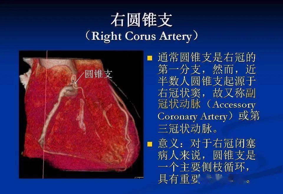 详细解读冠状动脉及冠心病ct