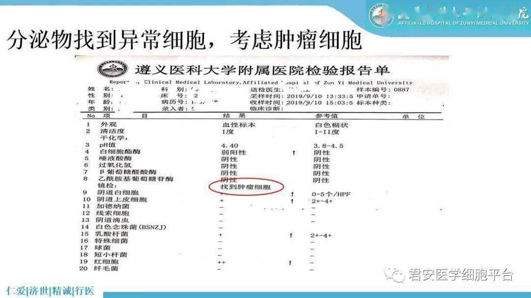 阴道分泌物检验的价值