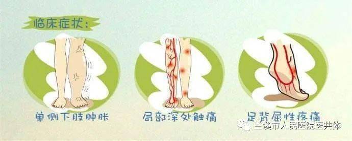 严重深静脉血栓比心梗更凶险_人群