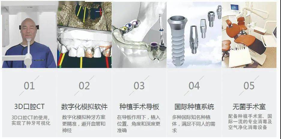完善的术前检查★数字化诊疗方案★种植导板技术让种植更精准★孺面