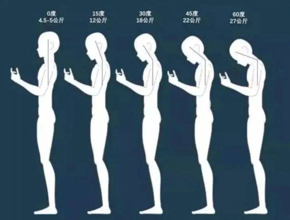 低头玩手机=头顶50斤!教你7个动作摆脱肩颈压力