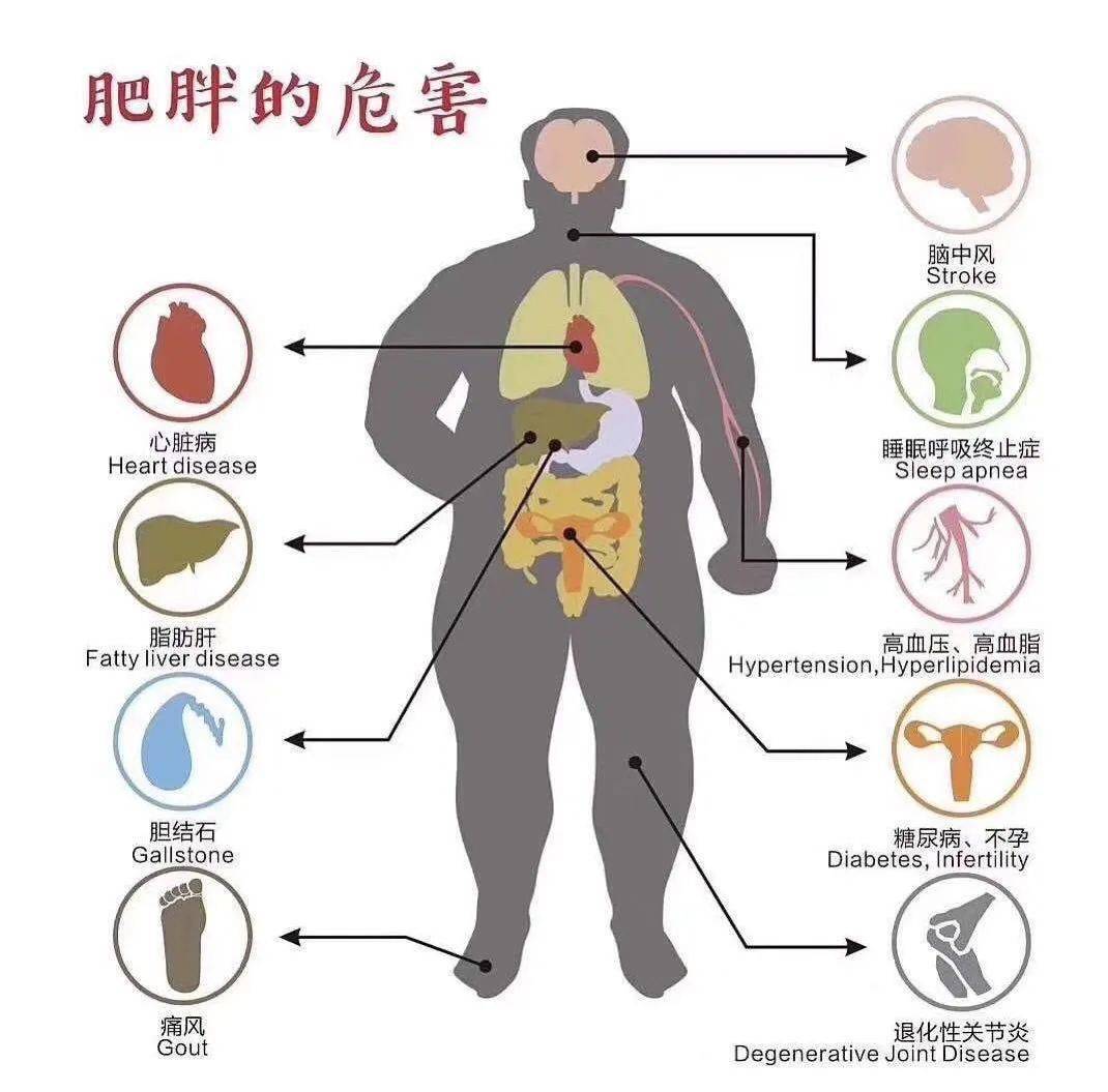 肥胖危害高清图片大全图片