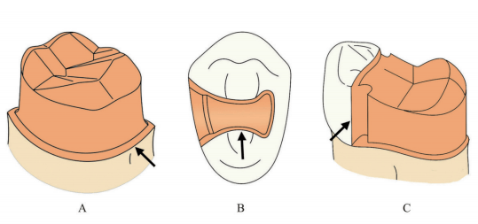 牙冠轴面图片