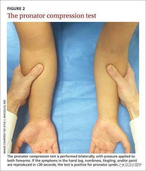 手肘疼痛,警惕旋前圆肌综合症,这些相关康复知识应该知道_手机搜狐网