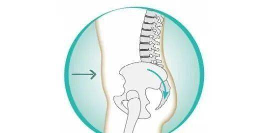 练习瑜伽,骨盆前倾该如何调整?卷尾骨?no
