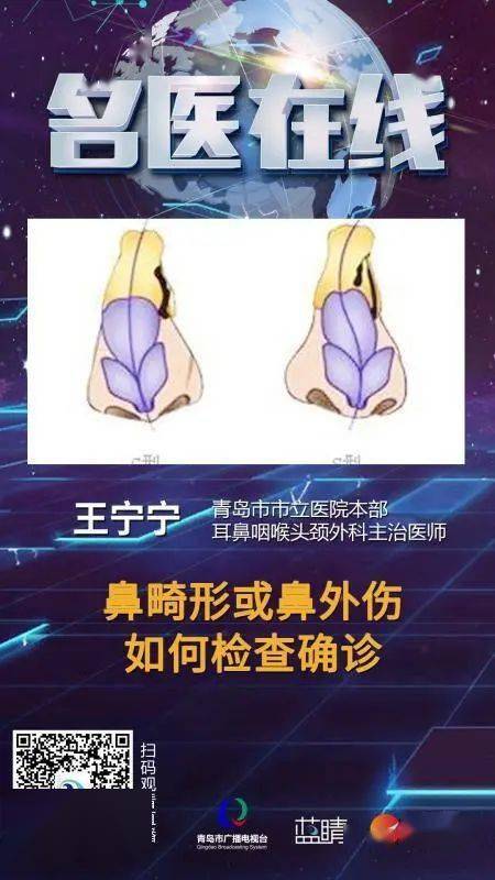 名医在线今日看点丨鼻畸形与鼻骨骨折的诊断治疗
