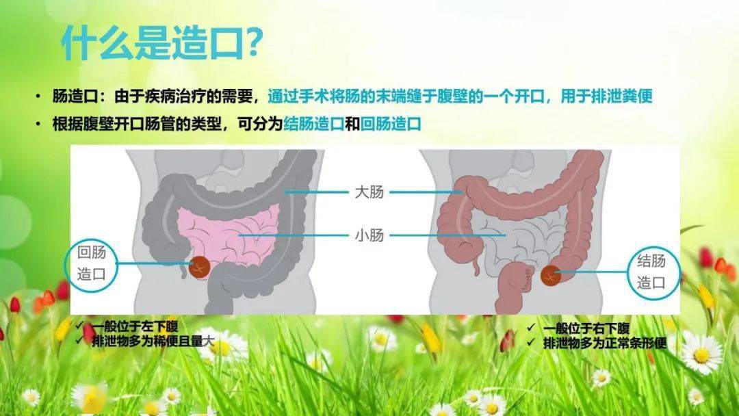 肠造口分类图片