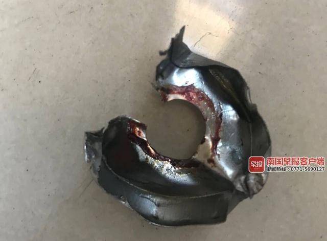 南宁一幼童大拇指被螺母卡住大哭不止,消防员唱儿歌实施救援