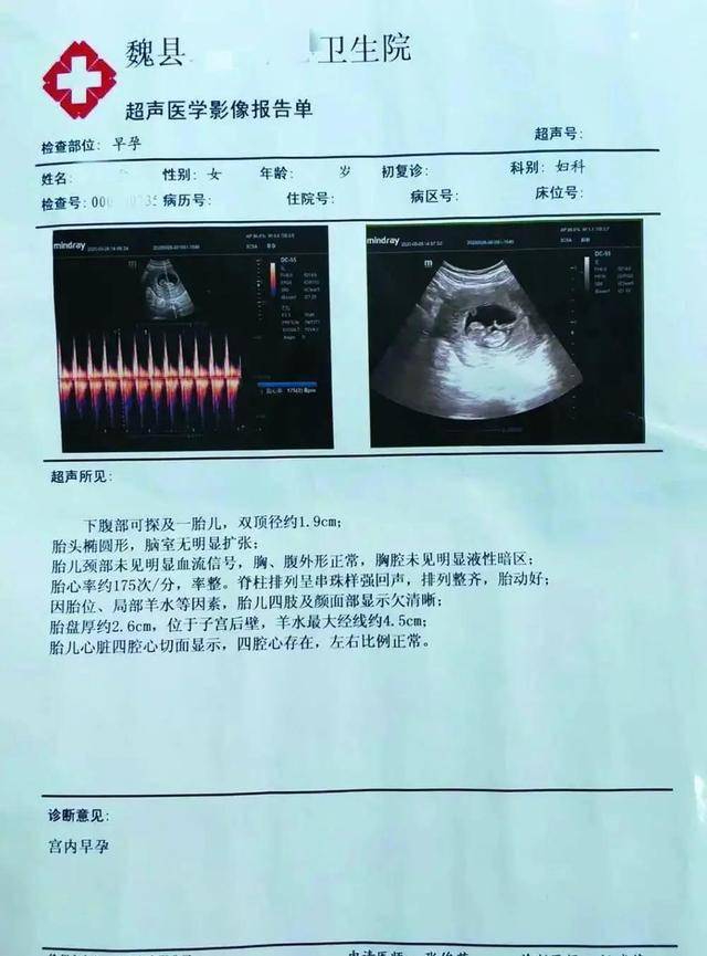 精神病女患者住院期间和男护工自愿发生关系怀孕?