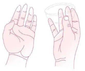 (三十四)35小指屈指试验(flexion test of litte finger)①嘱病人手掌