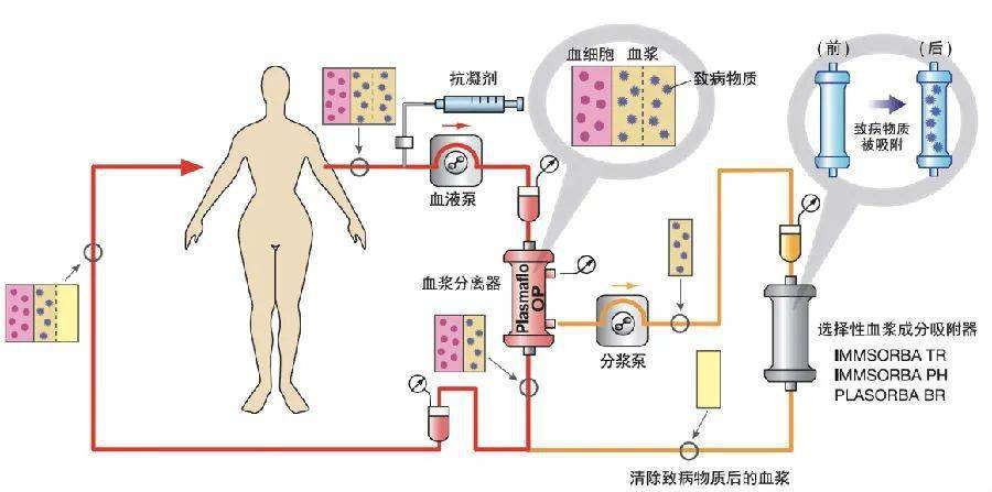 生物製劑等免疫修飾治療,造福了大量的重症肌無力,格林巴利綜合徵,視