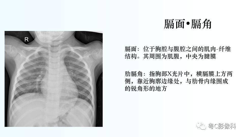 儿童胸部影像诊断基础病变