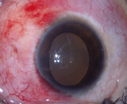 玻切新势力陆遥一玻三折内外兼修