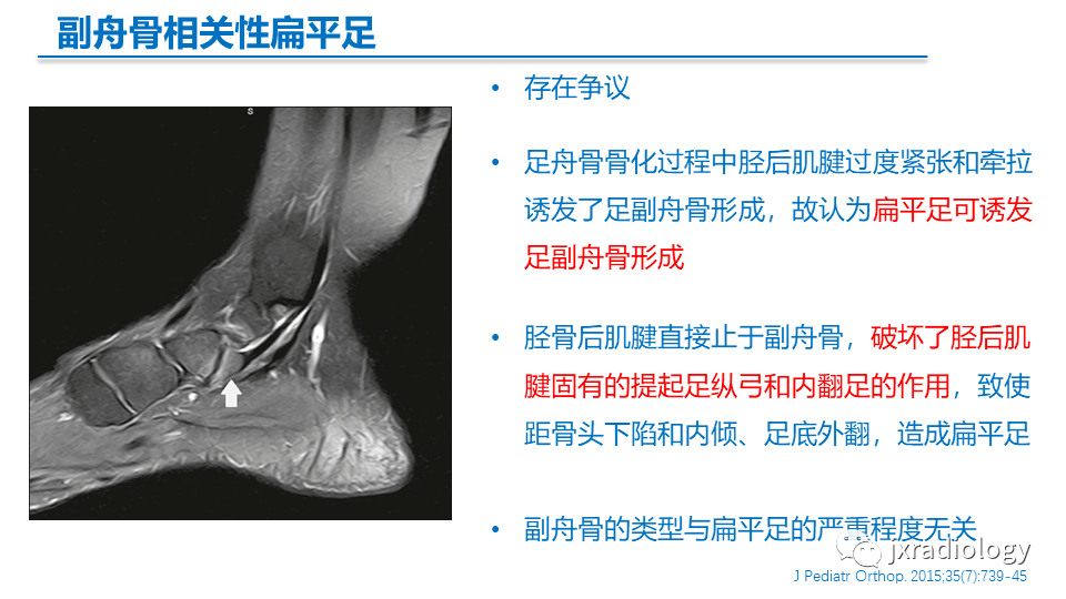 足副舟骨分型及相关病变的影像表现