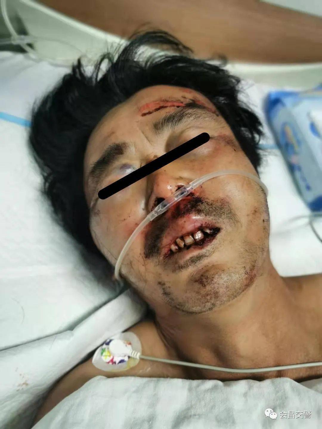 会昌老虎脑电站路段发生车祸一人重伤急寻家属或知情人