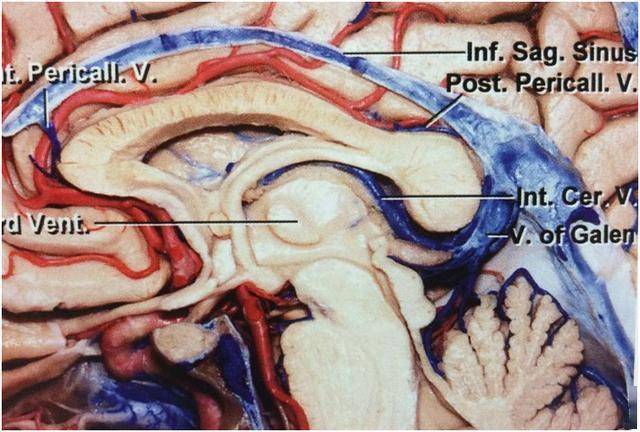 靜脈引流系統(基底靜脈,枕內側靜脈,大腦內靜脈及小腦中腦裂靜脈)
