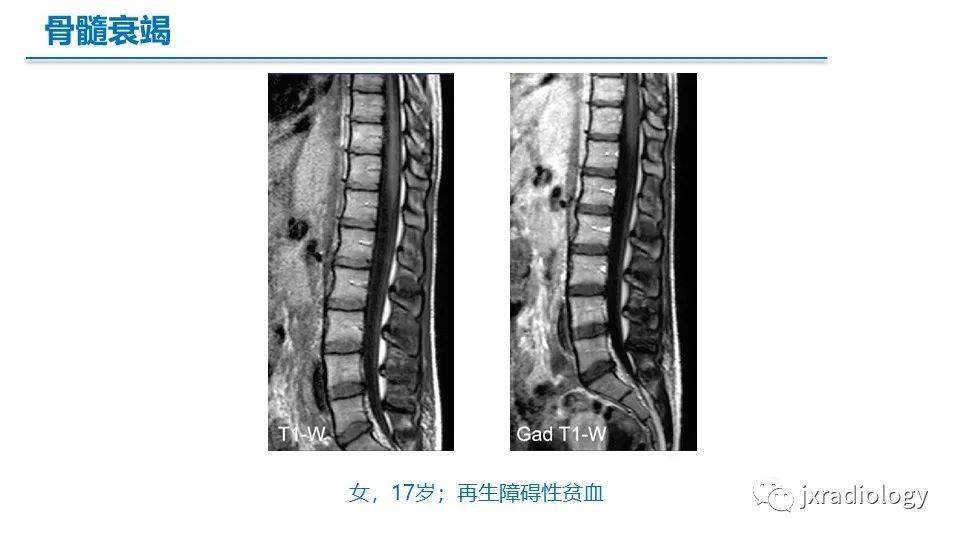 黄骨髓红骨髓图片