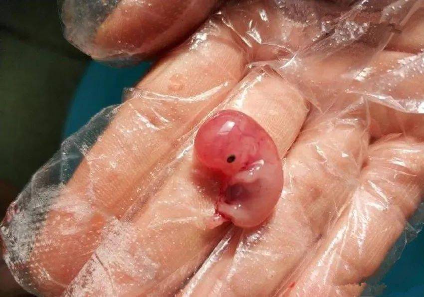 怀孕60天胚胎图片高清图片